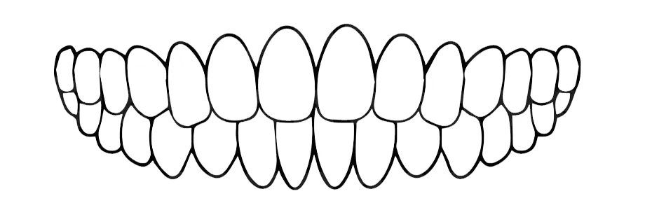 セラミック治療全歯