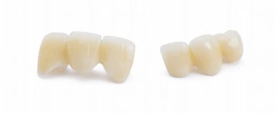 セラミック治療