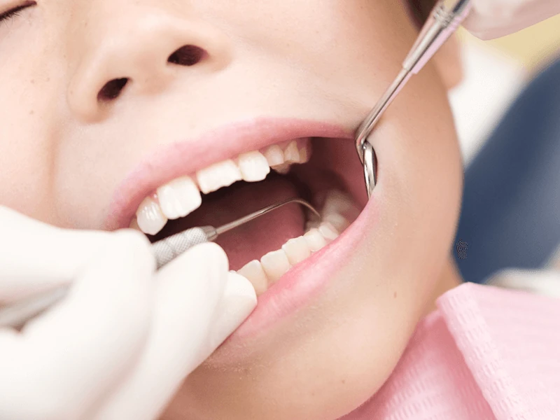 一般歯科イメージ写真