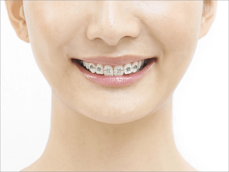 矯正歯科イメージ写真