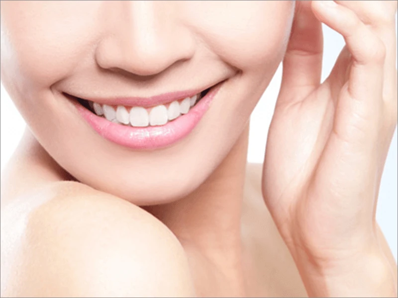 セラミック審美補綴イメージ写真