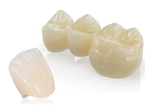 マウスピース矯正インビザライン写真