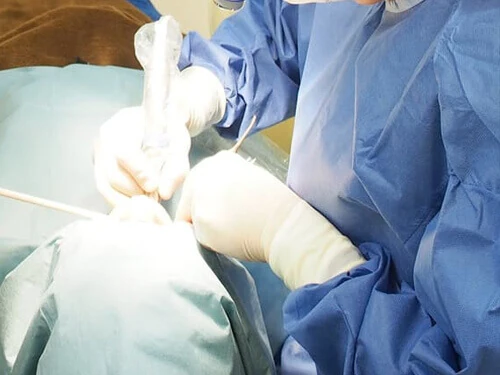 インプラントオペ風景