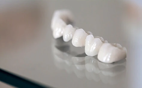 精度が高く虫歯になりにくいイメージ