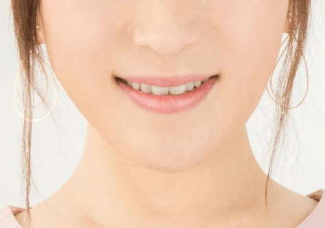 フッ素塗布イメージ