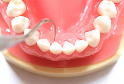 予防処置イメージ